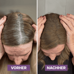 Hair Rich™ Ansatzpuder für graue Ansätze, Scheitel & Haarlinie