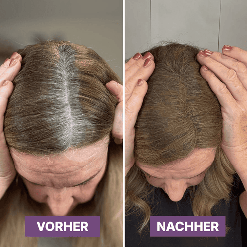 Hair Rich™ Ansatzpuder für graue Ansätze, Scheitel & Haarlinie