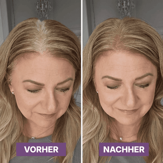 Hair Rich™ Ansatzpuder für graue Ansätze, Scheitel & Haarlinie