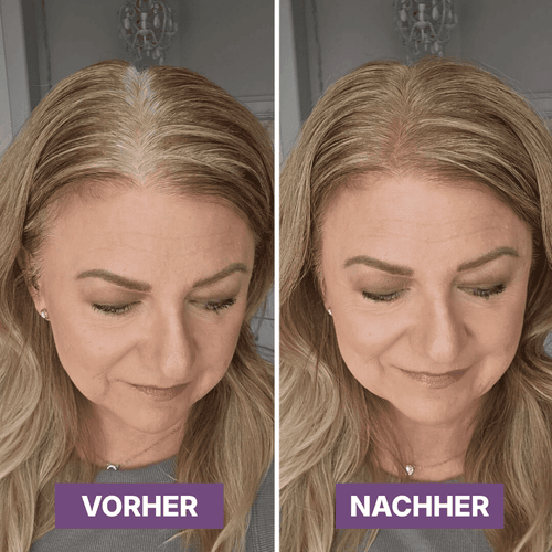 Hair Rich™ Ansatzpuder für graue Ansätze, Scheitel & Haarlinie